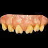 Trick Or Treat Studios The Texas Chainsaw Massacre (1974) - Leatherface Teeth
